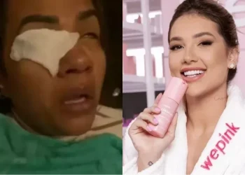 Mulher diz ter perdido a visão após usar produto de virginia fonseca